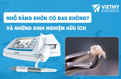 Nhổ Răng Khôn: Có Đau Không và Kinh Nghiệm Hữu Ích